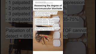 Assessing the degree of neuromuscular blockade [upl. by Sethrida]