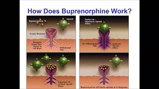 Buprenorphine for Opioid Use Disorders An Introduction [upl. by Nelrac]