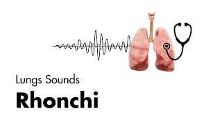 Rhonchi  Lung Sounds  Medzcool [upl. by Ettenuahs649]