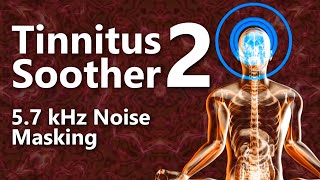 Tinnitus Soother 2 Noise 5700 Hz Focused Noise Masking [upl. by Waite]