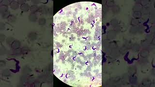 Trypanosoma under microscope microscopic parasitology Trypanosomiasis [upl. by Anaitat]