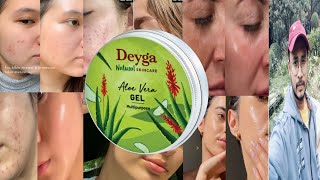 Deyga Aloe Vera Gel  Honest Review [upl. by Emoryt]