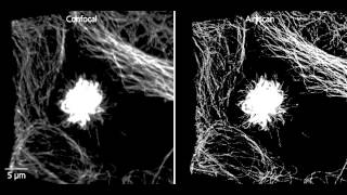 ZEISS LSM 880 Mitosis in tumor cells with Airyscan SR mode [upl. by Ellertal358]