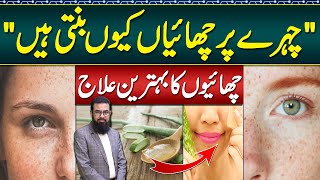 Melasma Treatment at Home  Melasma Cream and Melasma Home Remedies  Face Par Chaiyan Ka Ilaj [upl. by Nilat]