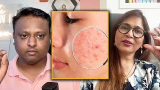 Celebrity Dermatologist Explains how Acne is formed theironikshowclips [upl. by Emery]