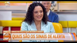 Sinais na pele o que devemos saber  Programa Manhã CM da CMTV [upl. by Seow]