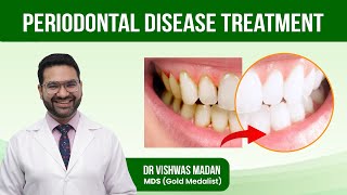 Periodontal Disease Treatment  GUM Disease  What is the Best Treatment for Periodontal Disease [upl. by Naujik]