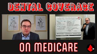 Medicare Dental Coverage [upl. by Ellyn]