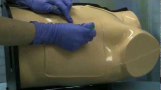 Chest Tube Placement Tulane Medicine [upl. by Ellett462]