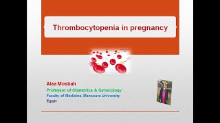 Thrombocytopenia in pregnancy [upl. by Rosene]