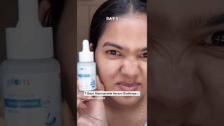 I applied niacinamide serum for 7 days trendingonshorts challenge [upl. by Sibylle]