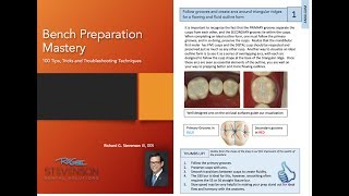 99 Seconds Tips  Outline Planning  Class II Amalgam Preparation [upl. by Atiuqiram]