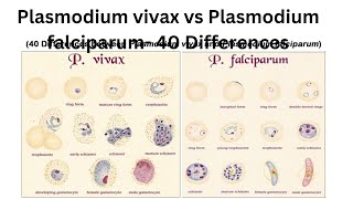 Plasmodium vivax vs Plasmodium falciparum 40 Differences [upl. by Aramit]