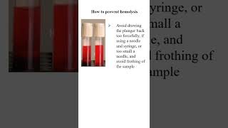 How to prevent hemolysis sample [upl. by Burroughs]