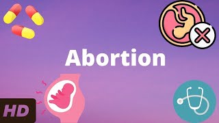 Abortion Everything You Need To Know [upl. by Danaher56]