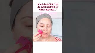 FOREO BEAR 2⚡30DAY CHALLENGE RESULTS 😮foreo bear2 30daychallenge [upl. by Ayikal]