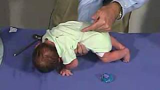 physical exam Newborn Normal Primitive Reflexes  Galant [upl. by Mehcanem]