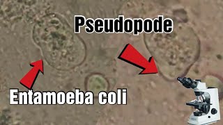 Entamoeba coli under the microscope pseudopods شاهد الأميبة تحت المجهر [upl. by Aryn]