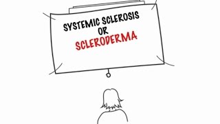 Understanding Systemic Sclerosis [upl. by Ethe]