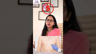 5 Facts Gynecomastia Surgery  Gyno Surgery के 5 जरूरी Facts manboobs chestfat yshort [upl. by Eidroj480]