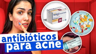 PRINCIPAIS ANTIBIÓTICOS PARA ACNE [upl. by Umeko262]