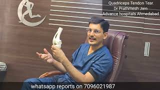 Quadricep Tendon tear Best treatment full detail in hindi [upl. by Draneb]