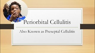 Periorbital Cellulitis Emergency [upl. by Fanchette]