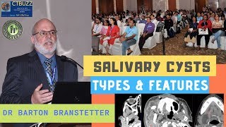 TMT Salivary Cysts by Dr Barton Branstetter [upl. by Nitsyrk23]