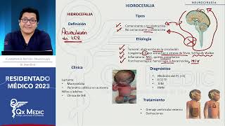 Neurocirugía  5 Hidrocefalia [upl. by Stedt700]