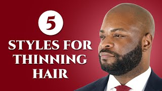 Is Your Hair Thinning Try These 5 Classic Mens Hairstyles [upl. by Eat]