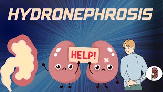 HYDRONEPHROSIS  Pathophysiology Causes signs and symptoms background diagnosis and treatment [upl. by Aubrie]