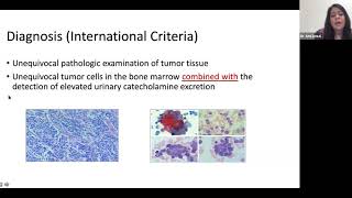 Neuroblastoma Basics Introduction to Neuroblastoma [upl. by Yhtir296]