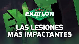 ¡Recordemos las lesiones más impactantes  Exatlón México [upl. by Pegg]