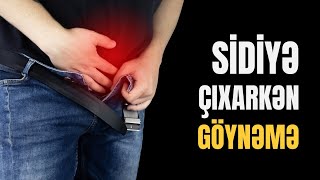 SİDİK KİSƏSİ xəstəlikləri Kimdə olur  Rüfət Əsədbəyli [upl. by Cari]