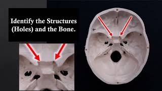 Bones Practical Exam Virtual Flash Cards for MSJC TMV [upl. by Oinotnaocram68]