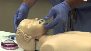 Airway Management [upl. by Ramedlaw]