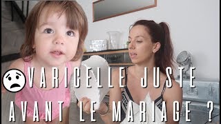 LA VARICELLE JUSTE AVANT LE MARIAGE  😒 VLOG FAMILLE [upl. by Lewiss249]