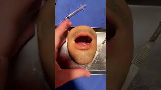 Fruit Surgery Mr Kiwis Return Sneak Peak MrKiwi FruitSurgery Shorts DiscountDentist Satisfying [upl. by Beverley]