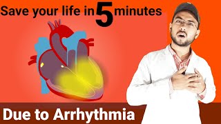 Sinus arrhythmia treatment  arrhythmia symptoms  tachycardia treatment  bradycardia treatment [upl. by Hertha340]