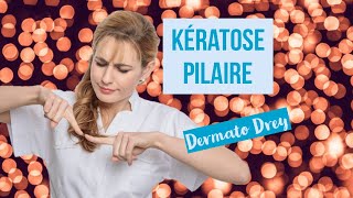 Kératose pilaire  boutons peau granuleuse poils incarnés comment se soigner  DermatoDrey [upl. by Dinsmore80]