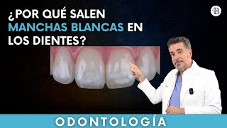 ¿Por qué salen MANCHAS BLANCAS en los dientes🦷 [upl. by Husha940]