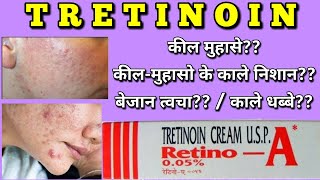 Tretinoin cream  Retino A cream uses side effects how to apply [upl. by Astraea]