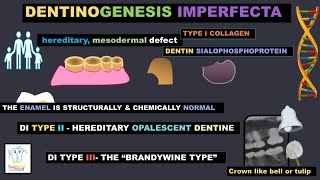 Dentinogenesis Imperfecta [upl. by Aihpled]