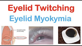 Eyelid Twitching Eyelid Myokymia  Triggers Pathophysiology Symptoms Diagnosis Treatment [upl. by Nodaj741]