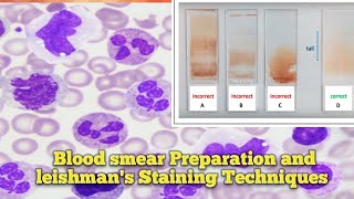 Blood smear Preparation l Leishmans Staining Techniques l Leishmans Staining Procedure ln Odia l [upl. by Beberg]