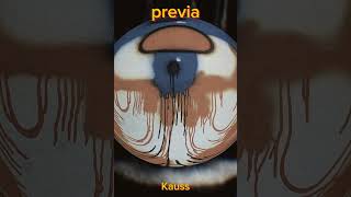 Sorte  Kauss Prod Nasser music rap song [upl. by Petronilla]