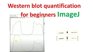 Quantification of western blot using imageJ for beginners  western blot quantification  imagej [upl. by Eked]