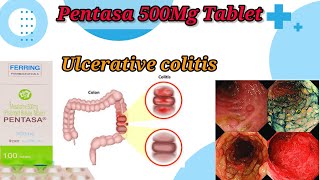 Pentasa 500Mg Tablet UseBenefitsSide EffectsUlcerative Colitis TreatmentFull Reviews [upl. by Orpah253]