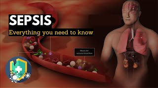 Sepsis Everything You Need to Know [upl. by Nodnol784]