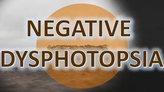 Negative Dysphotopsia  Management with the ND Ring [upl. by Eelyk]